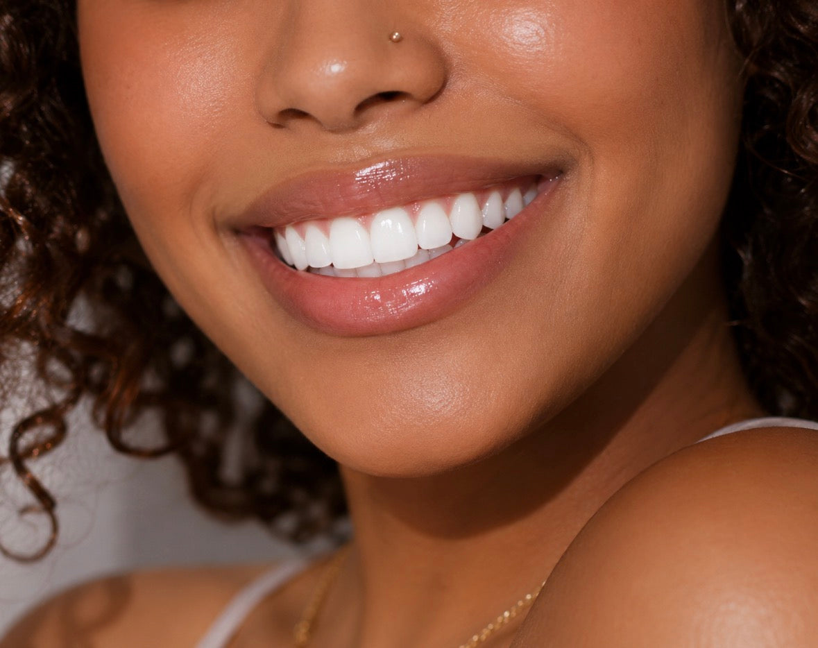 Signature Glow Teeth Whitening Appointment