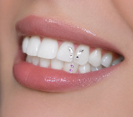 Tooth Gems Appointment